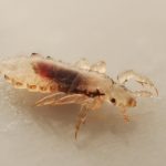 Head lice (louse) with blood meal visible