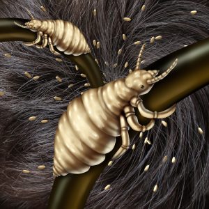 Head lice clinging to hair