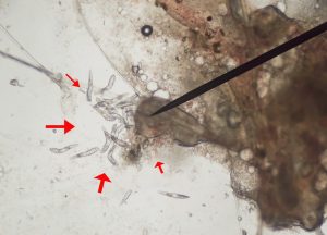 Demodex demodicosis parasitic mite living under skin