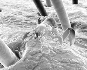 Itch mite entering hair follicle under electron microscope